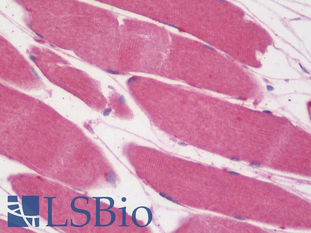 IHC-plus™ ALK3 / BMPR1A Antibody (aa179-378, clone 4B7B2)