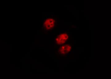 MDM2 Antibody (phospho-Ser166)