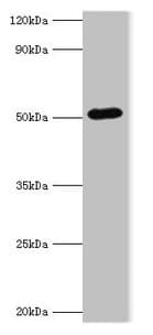 Polyclonal Rabbit anti-Human BAG5 Antibody (aa198-447, IHC, WB)