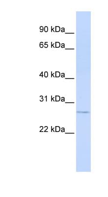 HsT19268 / MTHFS Antibody (aa107-156)
