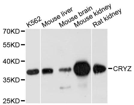Polyclonal Rabbit anti-Human CRYZ Antibody (WB)