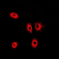 GOPC / PIST Antibody