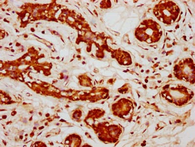 Polyclonal Rabbit anti-Human PPP2R1B Antibody (IHC, WB)