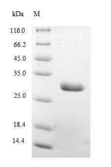 Borrelia burgdorferi OspA Protein (Recombinant 10His, N-terminus + Myc, C-terminus)