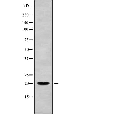 Polyclonal Rabbit anti-Human PPP3R2 Antibody (IHC, WB)