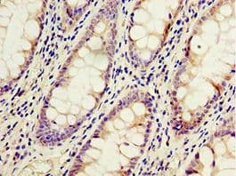 ACSM3 / SAH Antibody (aa387-586)