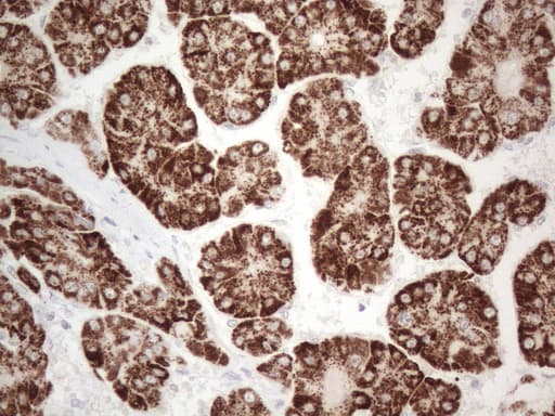 AMACR / P504S Antibody (clone OTI4D12)