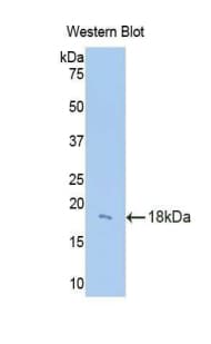 CFB / Complement Factor B Antibody (aa32-157)