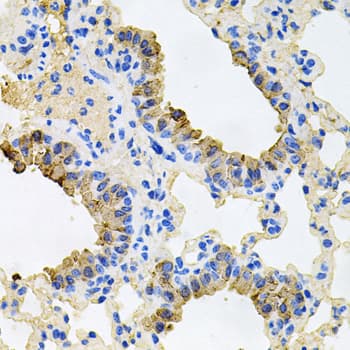 IGF1R / IGF1 Receptor Antibody