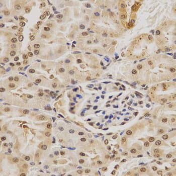 MDM2 Antibody