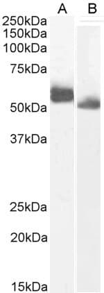 IHC-plus™ Polyclonal Goat anti-Human IRF4 Antibody (Amino Acids 393-407, IHC, WB)