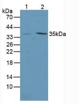 ITLN1 / Omentin Antibody (aa28-270)