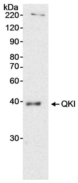 QKI Antibody (aa50-100)