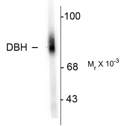 IHC-plus™ Polyclonal Sheep anti-Human DBH/Dopamine Beta Hydroxylase Antibody (N-Terminus, IHC, WB)