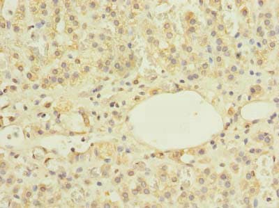Polyclonal Rabbit anti-Human ZBTB43 Antibody (IHC)
