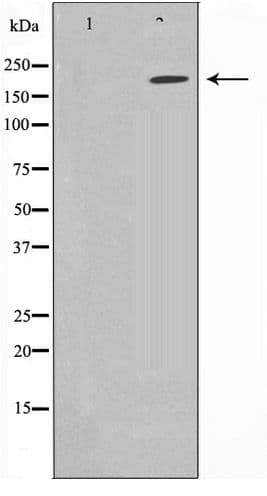 Polyclonal Rabbit anti-Human Sodium Channel Antibody (IHC, WB)