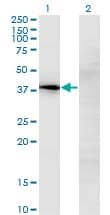 IHC-plus™ Monoclonal Mouse anti-Human CCN3 / NOV Antibody (clone 2G8, IHC, WB)