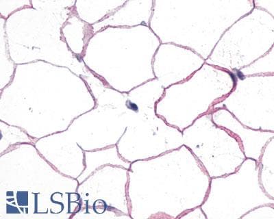 PathPlus™ GCGR / Glucagon Receptor Antibody (Extracellular Domain)