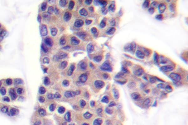 BAD Antibody (phospho-Ser91)