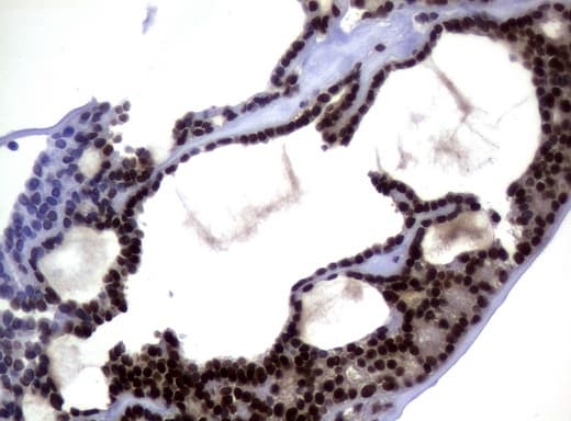 Monoclonal Mouse anti-Human MGMT Antibody (clone UMAB56, Carrier-free, IHC, IF, WB)