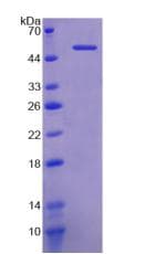 Mouse KL / Klotho Protein (Recombinant His)