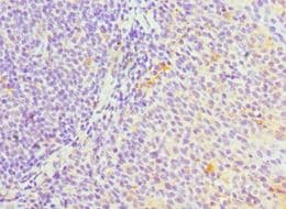 Polyclonal Rabbit anti-Human SERPINH1 / HSP47 Antibody (aa139-418, IHC, WB)
