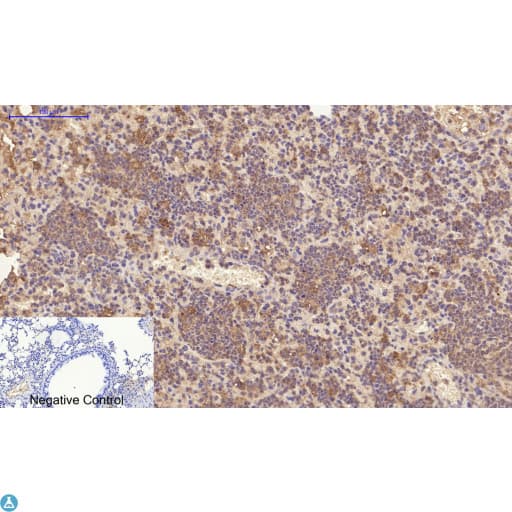 PDGFRA / PDGFR Alpha Antibody