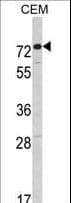AMHR2 / MISRII Antibody (aa374-402)