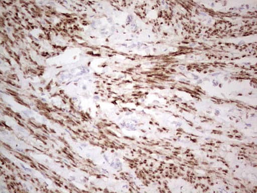 Monoclonal Mouse anti-Human PR / Progesterone Receptor Antibody (clone OTI4A11, aa1-298, IHC, WB)