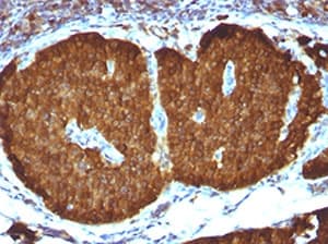 Monoclonal Mouse anti-Human ENO2 / NSE Antibody (clone NSEL1-1, IHC, IF, WB)