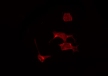 Polyclonal Rabbit anti-Human PR / Progesterone Receptor Antibody (phospho-Ser294, IF, WB)