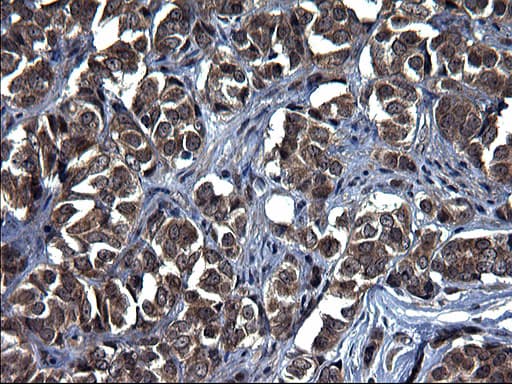 TXNDC5 / ERP46 Antibody (clone OTI2E6)