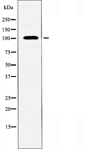 Polyclonal Rabbit anti-Human ATP2A1 / SERCA1 Antibody (IF, WB)