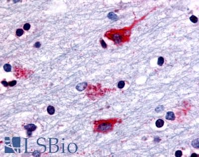 PathPlus™ CHRM2 / M2 Antibody (Cytoplasmic Domain)
