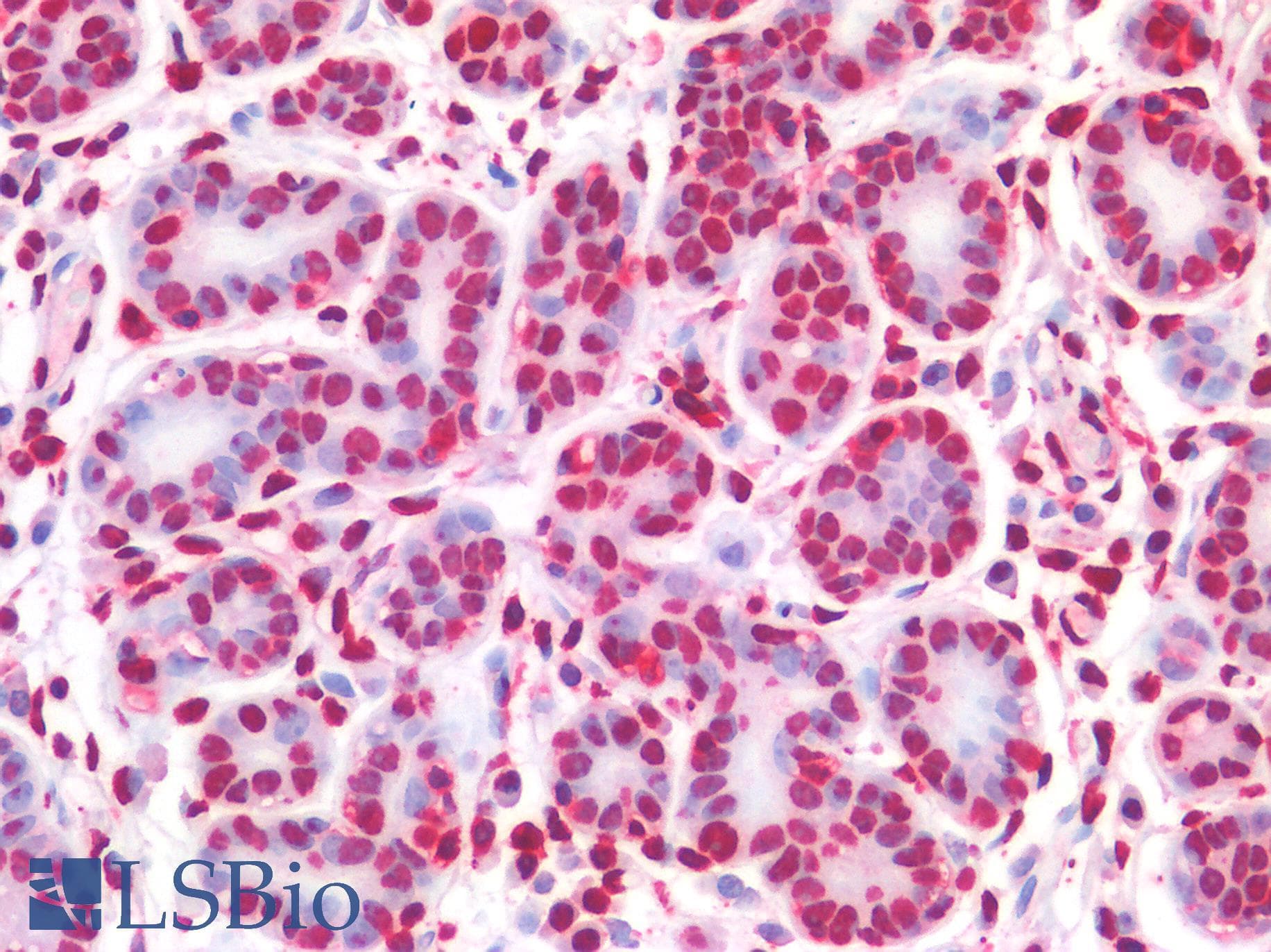 PathPlus™ NALP3 / NLRP3 Antibody