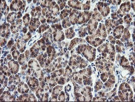 PIK3CG / PI3K Gamma Antibody (clone OTI6H5)