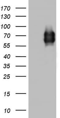 MCAM / CD146 Antibody (clone OTI5C4)