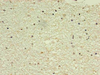 NPPB / BNP Antibody (clone 1E1F4)