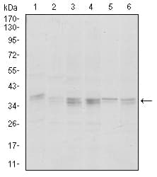 PPP1CA / PP1-Alpha Antibody (clone 5E9)
