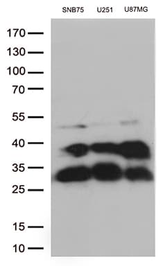 CTSL / Cathepsin L Antibody (aa114-333, clone OTI6D5, Carrier-free)