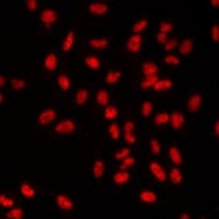 Polyclonal Rabbit anti-Human ETS2 Antibody (IF, WB)