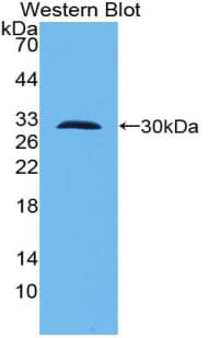 TLR10 Antibody (aa20-250, APC)