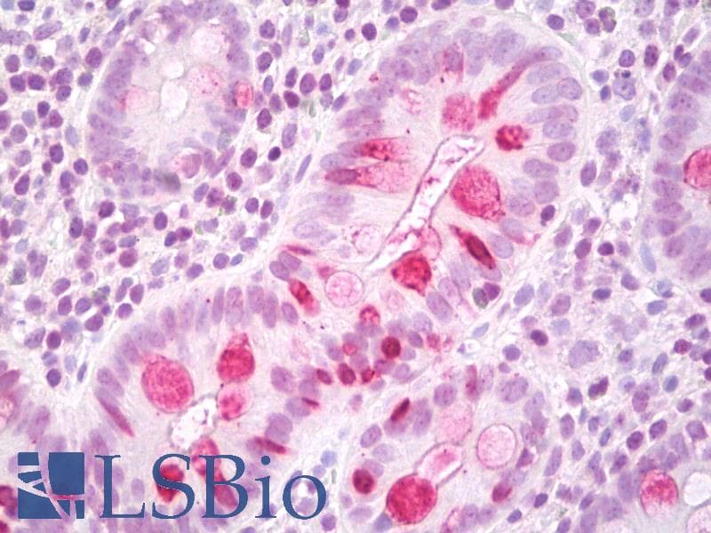 PathPlus™ Polyclonal Rabbit anti-Human TFF1 / pS2 Antibody (IHC, WB)