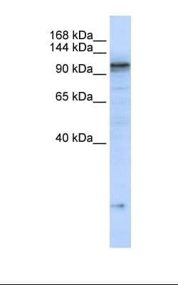 ATP2A2 / SERCA2 Antibody (aa794-843)