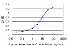 Monoclonal Mouse anti-Human SORD / Sorbitol Dehydrogenase Antibody (clone 4D3, IHC, WB)