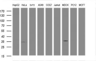 ARH / LDLRAP1 Antibody (clone OTI7A5)