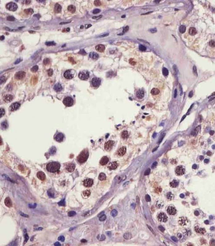 Polyclonal Rabbit anti-Human IRAK1 / IRAK Antibody (phospho-Ser376, IHC, IF, WB)