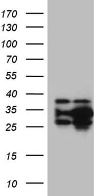 Monoclonal Mouse anti-Human DNAJB6 Antibody (clone OTI2F10, Carrier-free, WB)