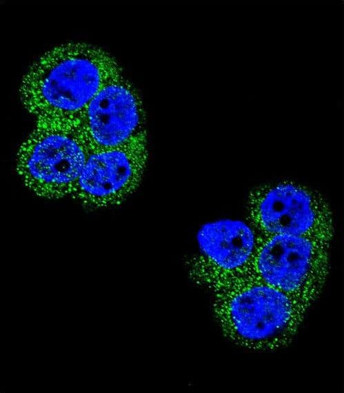 PDGFRB / PDGFR Beta Antibody