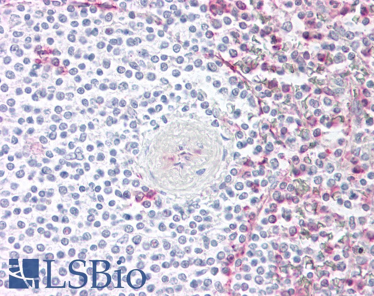 IHC-plus™ CCR4 Antibody (N-Terminus)